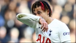 A sus 26 años de edad, la carrera de Dele Alli desciende en caída libre. Foto: Marca